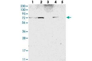 Western blot analysis of Lane 1: RT-4, Lane 2: U-251 MG, Lane 3: Human Plasma, Lane 4: Liver, Lane 5: Tonsil with ZNF846 polyclonal antibody . (ZNF846 antibody)