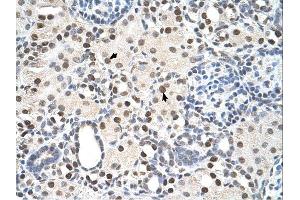 PSME3 antibody was used for immunohistochemistry at a concentration of 4-8 ug/ml.