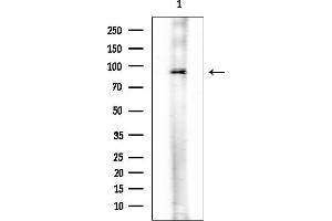 anti-MLK1/2 antibody