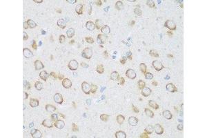 Immunohistochemistry of paraffin-embedded Mouse brain using DHODH Polyclonal Antibody at dilution of 1:100 (40x lens). (DHODH antibody)