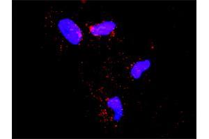 Proximity Ligation Analysis of protein-protein interactions between SMURF1 and ECSIT. (SMURF1 antibody  (AA 1-731))