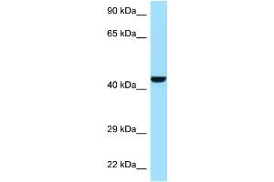 WB Suggested Anti-Gmppb Antibody   Titration: 1. (GMPPB antibody  (N-Term))