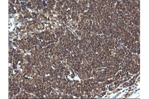 Image no. 4 for anti-Leucine Zipper and CTNNBIP1 Domain Containing (LZIC) antibody (ABIN1499239) (LZIC antibody)