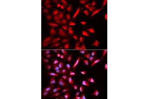 Immunofluorescence analysis of U2OS cells using PSMC3 antibody. (PSMC3 antibody  (AA 1-180))