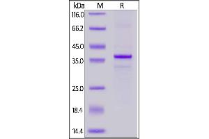 Cynomolgus CD20 Full Length, His Tag on  under reducing (R) condition. (CD20 Protein (AA 1-297) (His tag))