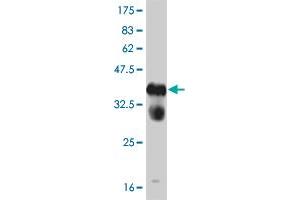 Western Blot detection against Immunogen (37. (FGFR1 antibody  (AA 303-408))