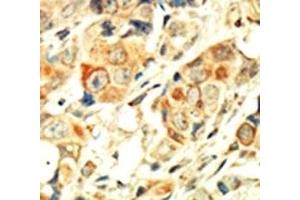 Immunohistochemistry (IHC) image for anti-Protein Kinase C, alpha (PKCa) (AA 299-329) antibody (ABIN3032373)