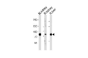 Western blot analysis of lysates from mousr kidney, rat kidney and liver tissue (from left to right), using EHHADH Antibody (C-term) (ABIN652576 and ABIN2842388).