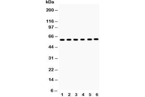 Western blot testing of EAAT2 antibody and Lane 1:  rat brain;  2: mouse brain;  3: U87;  4: SMMC-7721;  5: PANC;  6: A549;  Predicted size: 62KD;  Observed size: 62KD
