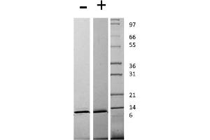 SDS-PAGE of Human Monocyte Chemotactic Protein-3 (CCL7) Recombinant Protein SDS-PAGE of Human Monocyte Chemotactic Protein-3 (CCL7) Recombinant Protein. (CCL7 Protein)