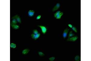Immunofluorescence staining of MCF-7 cells with ABIN7160568 at 1:100, counter-stained with DAPI. (Myosin antibody  (AA 1058-1195))
