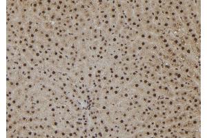 ABIN6265380 and ABIN6273078 at 1/100 staining Rat liver tissue by IHC-P.