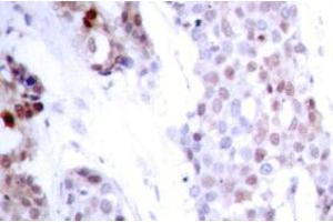 Image no. 1 for anti-Activating Transcription Factor 4 (Tax-Responsive Enhancer Element B67) (ATF4) (pSer245) antibody (ABIN317968) (ATF4 antibody  (pSer245))