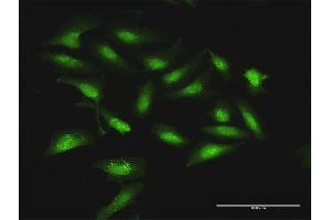 Immunofluorescence of purified MaxPab antibody to STOM on HeLa cell.