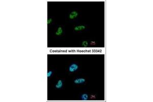 ICC/IF Image Immunofluorescence analysis of paraformaldehyde-fixed HeLa, using CHD4, antibody at 1:500 dilution. (CHD4 antibody  (N-Term))