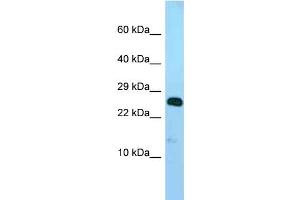 WB Suggested Anti-Ndufv2 Antibody Titration: 1. (NDUFV2 antibody  (N-Term))