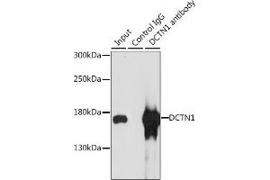 Immunoprecipitation analysis of 200 μg extracts of MCF-7 cells, using 3 μg DCTN1 antibody (ABIN3022541, ABIN3022542, ABIN3022543 and ABIN6218891).
