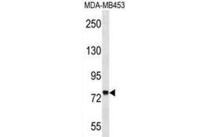 Western Blotting (WB) image for anti-Zinc Finger Protein 16 (ZNF16) antibody (ABIN2999236) (ZNF16 antibody)