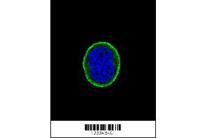 Confocal immunofluorescent analysis of IL10RA Antibody with MCF-7 cell followed by Alexa Fluor 488-conjugated goat anti-rabbit lgG (green). (IL-10RA antibody  (AA 147-175))