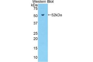 Western blot analysis of the recombinant protein. (Kallikrein 7 antibody  (AA 30-249))