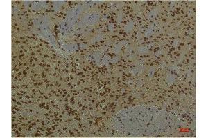 Immunohistochemistry (IHC) analysis of paraffin-embedded Mouse Brain Tissue using PI3 Kinase P85 alpha Mouse Monoclonal Antibody diluted at 1:200. (PIK3R1 antibody)