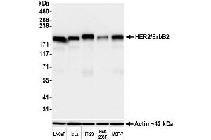 Western Blotting (WB) image for anti-Receptor tyrosine-protein kinase erbB-2 (ErbB2/Her2) (AA 1205-1255) antibody (ABIN7455181) (Recombinant ErbB2/Her2 antibody  (AA 1205-1255))