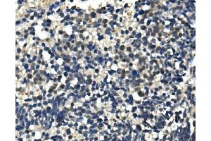IHC analysis of ULK1 using anti-ULK1 antibody (ABIN7602755). (ULK1 antibody  (C-Term))