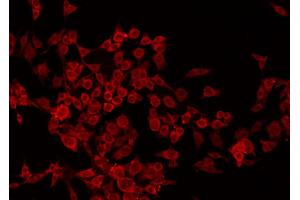 ABIN6266853 staining HuvEc by IF/ICC. (Transglutaminase 2 antibody  (N-Term))