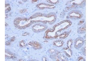 Formalin-fixed, paraffin-embedded human Prostate stained with Pan-Cytokeratin Mouse Monoclonal Antibody (PCK/3150). (KRT antibody)
