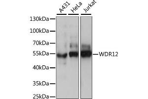 Western blot analysis of extracts of various cell lines, using WDR12 antibody (ABIN7271353) at 1:1000 dilution. (WDR12 antibody  (AA 1-280))