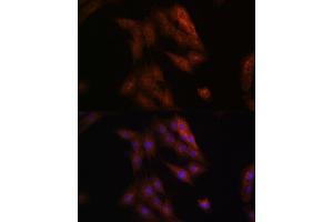 Immunofluorescence (IF) image for anti-Presenilin 1 (PSEN1) (AA 1-160) antibody (ABIN3023160)