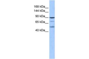 Western Blotting (WB) image for anti-Hairless (HR) antibody (ABIN2460608) (Hairless antibody)