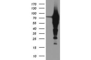 HEK293T cells were transfected with the pCMV6-ENTRY control (Left lane) or pCMV6-ENTRY EPN2 (Right lane) cDNA for 48 hrs and lysed. (Epsin 2 antibody)