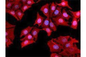 Immunofluorescence (IF) image for anti-Keratin 1 (KRT1) antibody (ABIN2664915) (Cytokeratin 1 antibody)