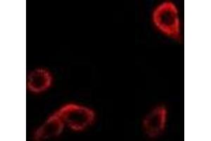 Immunofluorescent analysis of RRM1 staining in Hela cells. (RRM1 antibody)