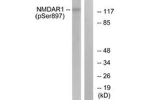 Western blot analysis of extracts from LOVO cells, using NMDAR1 (Phospho-Ser897) Antibody. (GRIN1/NMDAR1 antibody  (pSer897))