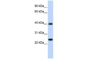 MESP1 antibody used at 0. (MESP1 antibody  (N-Term))