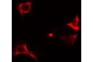 ABIN6274949 staining A549  cells by IF/ICC.