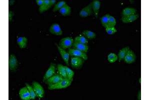 Immunofluorescent analysis of HepG2 cells using ABIN7159573 at dilution of 1:100 and Alexa Fluor 488-congugated AffiniPure Goat Anti-Rabbit IgG(H+L) (MAT2B antibody  (AA 85-143))
