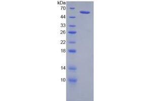 SDS-PAGE analysis of Rat Neuropilin 2 Protein.