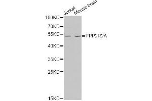 Western blot analysis of extracts of various cell lines, using PPP2R2A antibody.