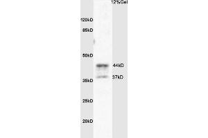 SDS-PAGE (SDS) image for anti-Coagulation Factor II (Thrombin) Receptor-Like 3 (F2RL3) (AA 320-343) antibody (ABIN673224)