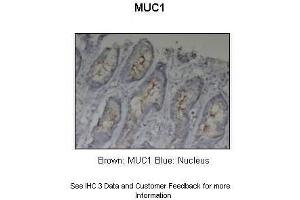 Sample Type :  Pig stomach  Primary Antibody Dilution :  1:5000 + 1:2000  Secondary Antibody :  Anti-rabbit-HRP  Secondary Antibody Dilution :  1:1000  Color/Signal Descriptions :  Brown: MUC1 Blue: Nucleus  Gene Name :  MUC1  Submitted by :  Dr.
