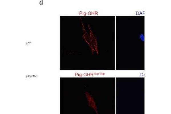 Growth Hormone Receptor antibody  (AA 101-200)