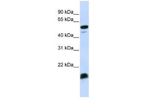 WB Suggested Anti-C4BPA Antibody Titration:  0. (C4BPA antibody  (Middle Region))