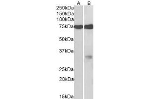 ABIN571279 (2µg/ml) staining of fetal Mouse (A) and Rat (B) Brain lysates (35µg protein in RIPA buffer). (GPM6A antibody  (Internal Region))