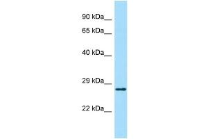 Host: Rabbit Target Name: ABHD14A Sample Type: Fetal Kidney lysates Antibody Dilution: 1. (ABHD14A antibody  (Middle Region))
