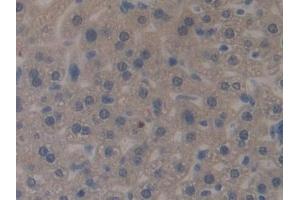 Detection of MUC1 in Mouse Liver Tissue using Polyclonal Antibody to Mucin 1 (MUC1) (MUC1 antibody  (AA 474-630))