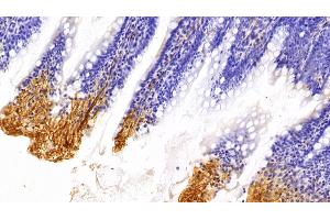 Immunohistochemistry (IHC) image for anti-Caveolin 1, Caveolae Protein, 22kDa (CAV1) (AA 2-105) antibody (ABIN7431326)