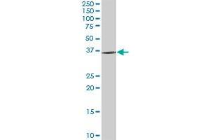 DIMT1 antibody  (AA 1-313)